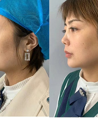 Ѹı˱Ӻ°ͣо˺ܶ࣬ҲĶ