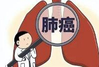 39岁的我不抽烟不喝酒,得了肺癌