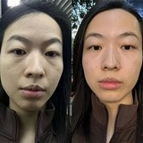 原来泪沟真的这么显老