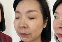 换季皮肤太干怎么办?做一次水光+BB光就行