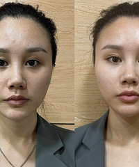 都去这样打水光,效果更惊艳!长效补水、提亮肤色、淡细纹和毛孔