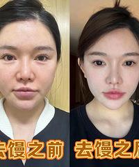 面部发抛、馒化,快来看看我的祛馒正确方法!其实挺简单