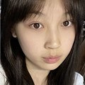 祛眼袋后都不用P图了