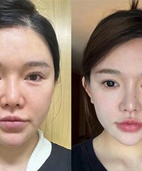 快来看看我的脸部“消肿”方法