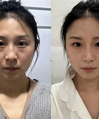 û���۴�������ȥ��������5��