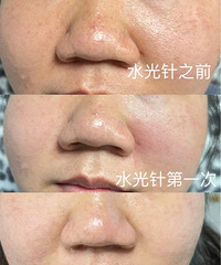 35ҵʺԼˮ⣬2ΣƤ仯ͺô