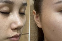 这样打水光,效果更惊艳!长效补水、提亮肤色