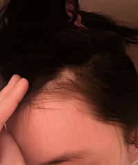 知名女演员自曝患病!“就很突然…