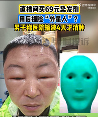 用了直播间染发剂撞脸外星人
