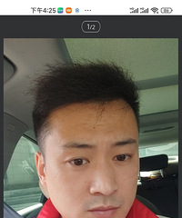 91174CMƵĸ飬ϣԷ25~30