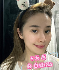 我做了秋冬的第一支长效水光,袪黄美白的效果,简直太好了