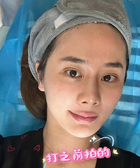 秋冬的第一支长效水光,袪黄美白效果太好了