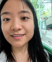 1000度还带散光,高度近视做完近视手术后,说说真实感受