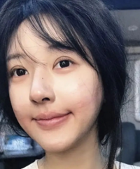 赵露思现在的脸,真心觉得遗憾