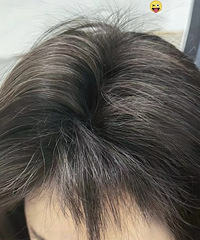 大家怎么解决头油问题的?五花八门的方法还真多