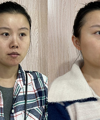 这个方法能一次性祛痘祛痘印,改善毛孔粗大皮肤泛红,提亮肤色!