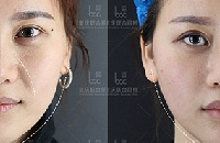 沿˥1280 Ƥ꿨1980 ˮ꿨1399