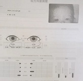 六月龄娃远视储备为负