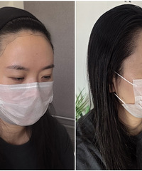 轻松“长”出发际线的方法来了!只要3小时,拯救你的大脑门