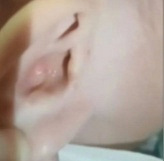 宝宝掏耳,戳出脑脊液