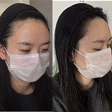 发际线也可以再长出来