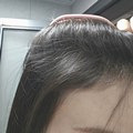 发际线长出一堆杂毛