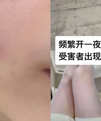 第一批电热毯受害者出现了!