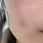 第一批电热毯受害者