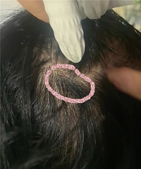 记录我六年的增发经历,这些坑已经帮你们踩过了