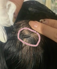 记录6年增发经历,这些坑已经帮你们踩过!现在头发真长出来了