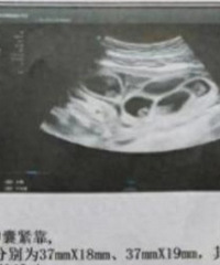 怀9胞胎的女子表示:医院要担责