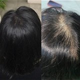 记录我的6年增发经历