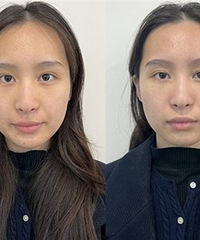 这些做了真有效,一次皮肤就改善了