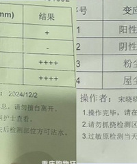 尘螨脱敏:每天滴药舌下脱敏,医生说要坚持三五年
