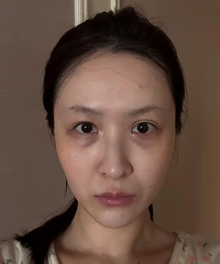 猜猜我做了哪些改变?最火的“变美三件套”我都做了,像换了个人