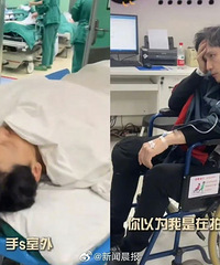 主持人百克力被鱼刺穿胃扎到肝