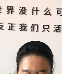 凭借我对头发的执念,终于做了比较满意的增发