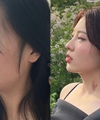 下颌缘轮廓分明,整个人更有气质啦