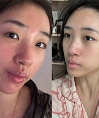 做了水光之后,肤色变化还真大