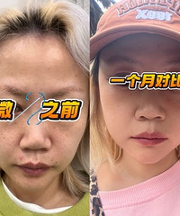 做这个真的能改善毛孔粗大问题,我先帮你们试了
