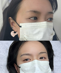 还好我纹眉前做了攻略,断层的眉毛也能纹野生眉,还一点不痛