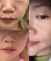 皮肤粗糙毛孔大,做了这个后像新生一样