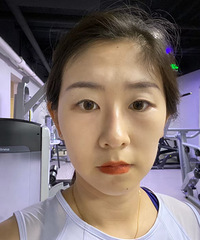 热玛吉做了三个月,看来确实是每年都要做的项目