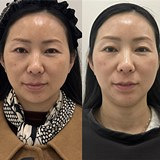 黑金超光子便宜还有效