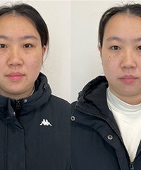 想要变白,试试黄金超光子全模式