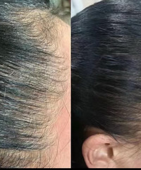 ͷȾѵûİ취𣿲ͽģ˵˵