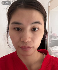 热玛吉到底适合瘦脸做吗?我给你们去试了试