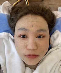 做了热玛吉4代,不仅抗衰效果好,而且还真没想象中的痛