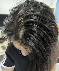 说一说油头消失的原因,已经保持三个月
