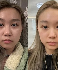 �������꼪����˥Ч���û�û��ôʹ